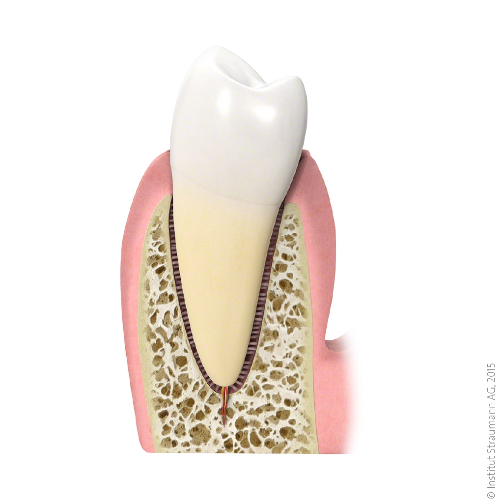 Gesunder Zahn mit gesundem Zahnfleisch